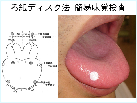 ろ紙ディスク法