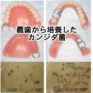 義歯から培養したカンジダ菌(下記の写真)