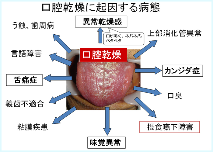 口腔乾燥に起因する病態