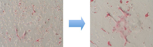 Images of osteoclastic cell differentiation