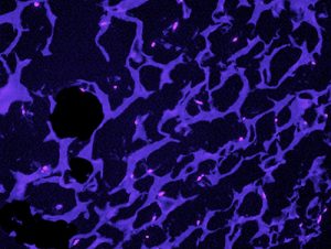 Image of collagen sponge cell plug